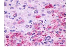 Immunohistochemical staining of human ovary sections (corpus luteum) using LHR antibody (LHCGR anticorps  (C-Term))