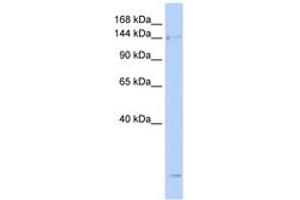 Image no. 1 for anti-Structural Maintenance of Chromosomes 4 (SMC4) (AA 36-85) antibody (ABIN6743408) (SMC4 anticorps  (AA 36-85))