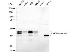 Western blotting analysis using NK2 homeobox 1 antibody (ABIN7799607). (Recombinant NKX2-1 anticorps)
