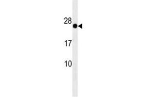 GAGE12F antibody western blot analysis in HepG2 lysate (G Antigen 12F anticorps  (AA 1-30))