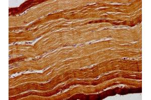 IHC image of ABIN7168596 diluted at 1:300 and staining in paraffin-embedded human skeletal muscle tissue performed on a Leica BondTM system.