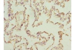 Immunohistochemistry of paraffin-embedded human lung tissue using ABIN7151524 at dilution of 1:100