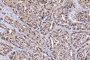 IHC analysis of FEN1 using anti-FEN1 antibody (ABIN7601618). (FEN1 anticorps  (AA 4-300))