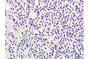 Formalin-fixed and paraffin embedded human adrenal tissue labeled with Anti LHR/CGR Polyclonal Antibody, Unconjugated (ABIN873328) followed by conjugation to the secondary antibody and DAB staining (LHCGR anticorps  (AA 201-300))