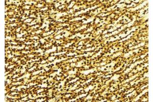 ABIN6269389 at 1/100 staining Human gastric tissue by IHC-P.