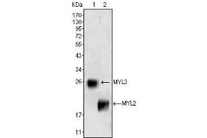 Western Blot showing MYL3 (1) and MYL2 (2) antibody used against rat fetal heart tissues lysate. (MYL3/CMLC1 anticorps)
