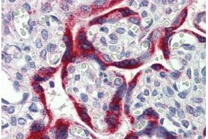 Placenta, Human: Formalin-Fixed, Paraffin-Embedded (FFPE)