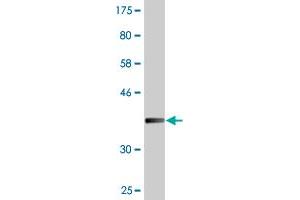 Western Blot detection against Immunogen (36. (TNNI2 anticorps  (AA 2-100))