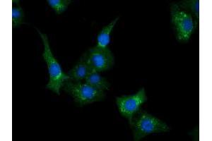 Immunofluorescence (IF) image for anti-ClpP Caseinolytic Peptidase, ATP-Dependent, Proteolytic Subunit Homolog (E. Coli) (CLPP) antibody (ABIN1497536)
