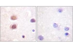 Immunohistochemistry analysis of paraffin-embedded human brain, using p38 MAPK (Phospho-Tyr322) Antibody.