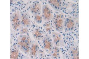 IHC-P analysis of Human Tissue, with DAB staining. (PIK3CD anticorps  (AA 774-1044))