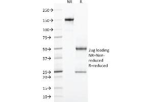SDS-PAGE Analysis Purified CD103 Mouse Monoclonal Antibody (ITGAE/2474). (CD103 anticorps)