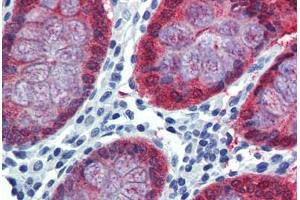 Colon, Human: Formalin-Fixed, Paraffin-Embedded (FFPE)