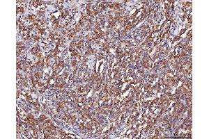 IHC analysis of ENO1 using anti-ENO1 antibody (ABIN7601902). (ENO1 anticorps  (AA 50-250))
