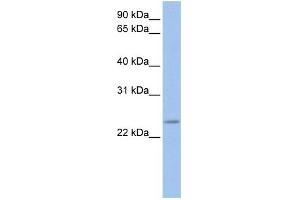 WB Suggested Anti-FKBP3 Antibody Titration: 0.