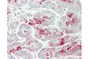 Formalin-fixed and paraffin-embedded H.