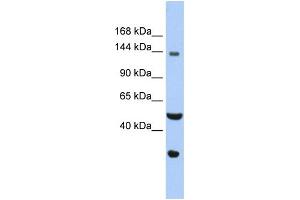 WB Suggested Anti-WDHD1 Antibody Titration: 0. (WDHD1 anticorps  (C-Term))