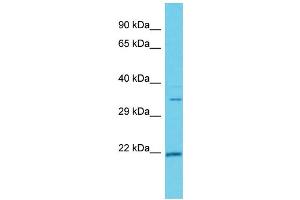 Host: Rabbit  Target Name: Hmgcl  Sample Tissue: Rat Thymus lysates  Antibody Dilution: 1. (HMGCL anticorps  (C-Term))