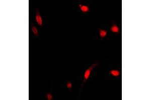 Immunofluorescent analysis of NF-kappaB p65 staining in MCF7 cells. (NF-kB p65 anticorps  (Center))