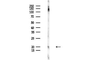 Western blot analysis of lysates from Rat liver, using CPLX2 Antibody at 1/1000 dilution.