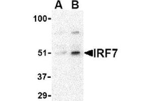 Image no. 1 for anti-Interferon Regulatory Factor 7 (IRF7) (Middle Region) antibody (ABIN265130) (IRF7 anticorps  (Middle Region))