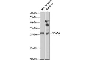 Western blot analysis of extracts of various cell lines, using SOX14 antibody (ABIN6130912, ABIN6148291, ABIN6148293 and ABIN6223049) at 1:1000 dilution. (SOX14 anticorps  (AA 91-240))