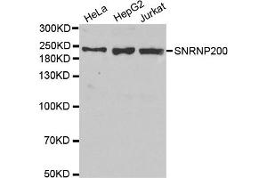 Western Blotting (WB) image for anti-Small Nuclear Ribonucleoprotein 200kDa (U5) (SNRNP200) antibody (ABIN1877090) (SNRNP200 anticorps)