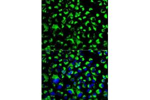 Immunofluorescence analysis of U2OS cells using HSPA9 antibody.