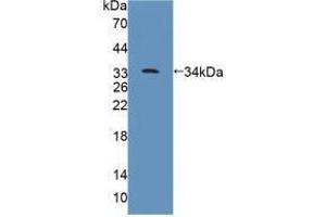 Western blot analysis of recombinant Rat PTPRB. (PTPRB anticorps  (AA 1041-1310))