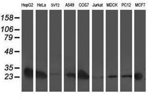 Image no. 8 for anti-Adenylate Kinase 4 (AK4) antibody (ABIN1496525)