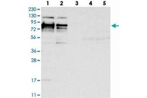 Western blot analysis of Lane 1: RT-4, Lane 2: U-251 MG, Lane 3: Human Plasma, Lane 4: Liver, Lane 5: Tonsil with HS6ST2 polyclonal antibody  at 1:250-1:500 dilution.