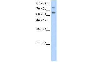 WB Suggested Anti-ZSCAN2 Antibody Titration:  0. (ZSCAN2 anticorps  (N-Term))