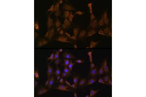 Immunofluorescence analysis of C6 cells using SND1 Rabbit pAb (ABIN6129741, ABIN6148197, ABIN6148199 and ABIN6221577) at dilution of 1:100 (40x lens).