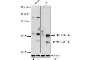 Western blot analysis of extracts of various cell lines, using Phospho-PLN-S16/T17 antibody (ABIN7269330) at 1:1000 dilution. (Phospholamban anticorps  (pSer16, pThr17))