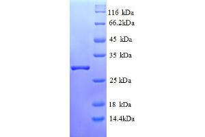 SDS-PAGE (SDS) image for V-Set Domain Containing T Cell Activation Inhibitor 1 (VTCN1) (AA 26-258), (partial) protein (His tag) (ABIN5712834)