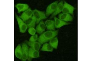ICC/IF staining of HeLa cells, fixed with 4% Paraformaldehyde, using FASN antibody at 1:200. (Fatty Acid Synthase anticorps)