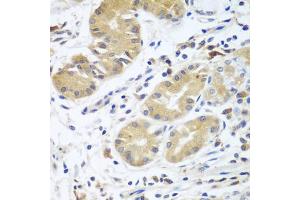 Immunohistochemistry of paraffin-embedded human stomach using CFD antibody (ABIN5974492) at dilution of 1/100 (40x lens). (Adipsin anticorps)