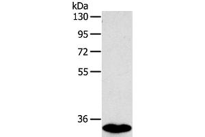 Western Blot analysis of Human fetal intestines tissue using SULT1B1 Polyclonal Antibody at dilution of 1:800 (SULT1B1 anticorps)