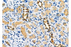 ABIN6264110 and ABIN6273291 at 1/100 staining Rat kidney tissue by IHC-P.