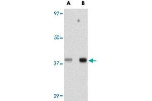 Western blot analysis of TREX1 in human spleen tissue lysate with TREX1 polyclonal antibody  at (A) 0. (TREX1 anticorps  (Internal Region))