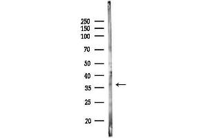 anti-T-Cell Acute Lymphocytic Leukemia 1 (TAL1) (C-Term) antibody