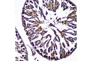 Immunohistochemistry of paraffin-embedded Rat testis using CTNN Rabbit pAb (ABIN7266136) at dilution of 1:100 (40x lens).