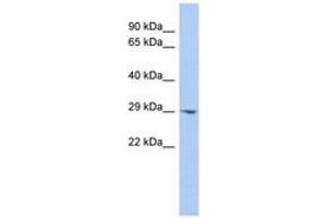 Image no. 1 for anti-Enoyl CoA Hydratase Domain Containing 2 (ECHDC2) (AA 143-192) antibody (ABIN6743494) (ECHDC2 anticorps  (AA 143-192))