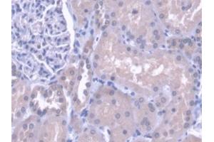 DAB staining on IHC-P; Samples: Human Kidney Tissue
