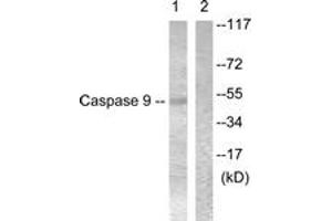 Western blot analysis of extracts from 293 cells, treated with Calyculin 50nM 30', using Caspase 9 (Ab-196) Antibody. (Caspase 9 anticorps  (AA 162-211))