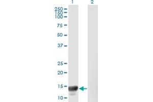 Western Blot analysis of MACF1 expression in transfected 293T cell line by MACF1 monoclonal antibody (M08), clone 1G9.