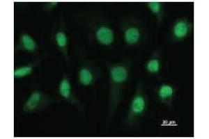 Immunostaining analysis in HeLa cells. (ETV3 anticorps)