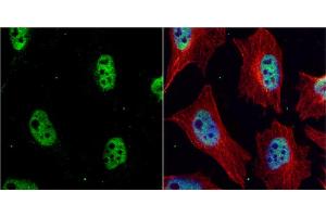 ICC/IF Image CHK1 antibody [C1C2-6], Internal detects Chk1 protein at nucleus by immunofluorescent analysis. (CHEK1 anticorps)