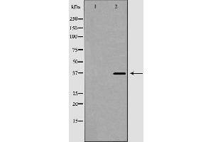 Western blot analysis of MCF7 cell lysate, using GP9 Antibody. (CD42a anticorps  (Internal Region))