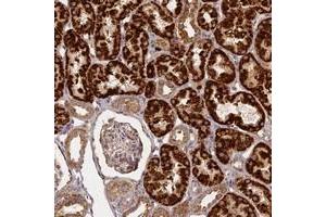 Immunohistochemical staining of human kidney with KRT78 polyclonal antibody  shows strong granular cytoplasmic positivity in cells in renal tubules. (Keratin 78 anticorps)
